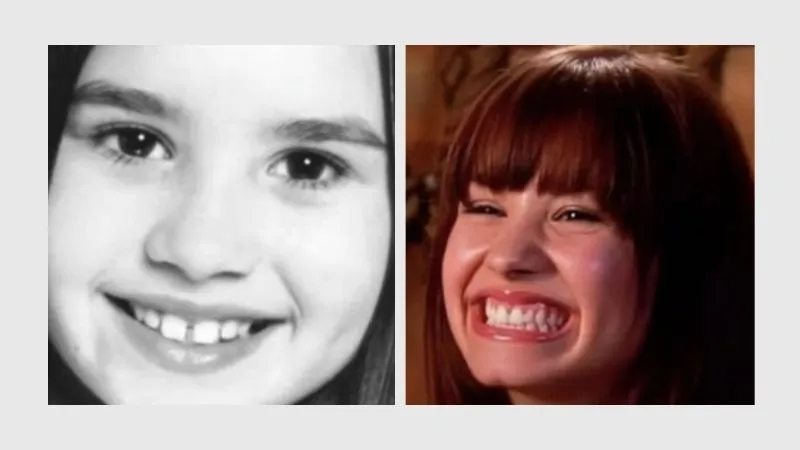 Demi Lovato Teeth Demi Lovato Teeth