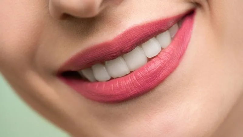 Hollywood Smile Hollywood Smile